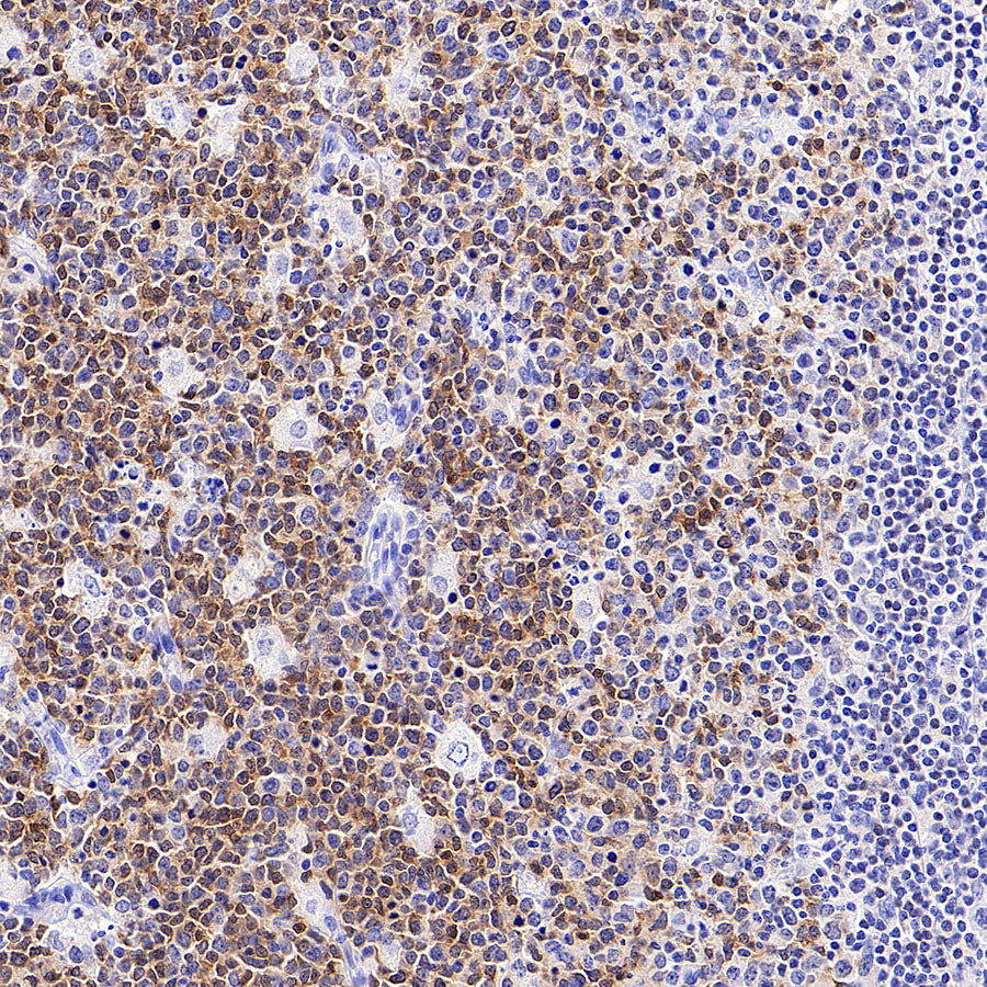 BACH2 Rabbit Polyclonal Antibody