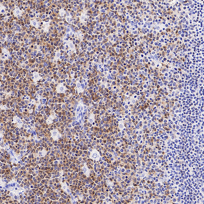 BACH2 Rabbit Polyclonal Antibody