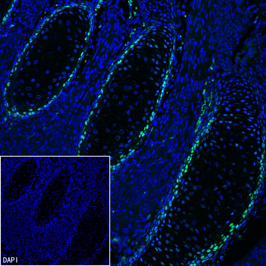 Sp7/Osterix Recombinant Rabbit mAb (S-4225-14)