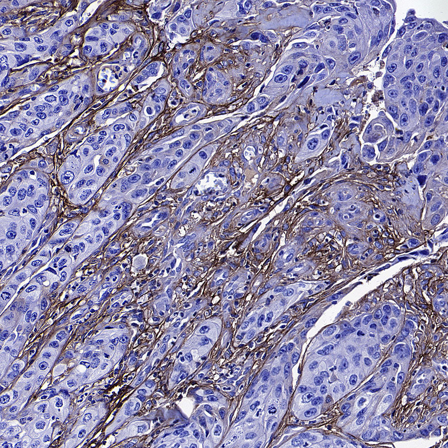 TGFBI / BIGH3 Mouse mAb