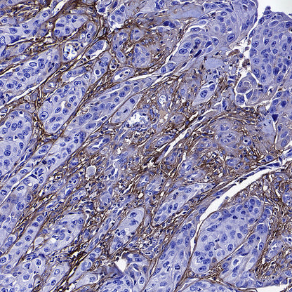 TGFBI / BIGH3 Mouse mAb