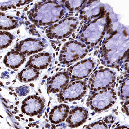 Histone H3 (mono methyl K36) Recombinant Rabbit mAb (S-859-505)