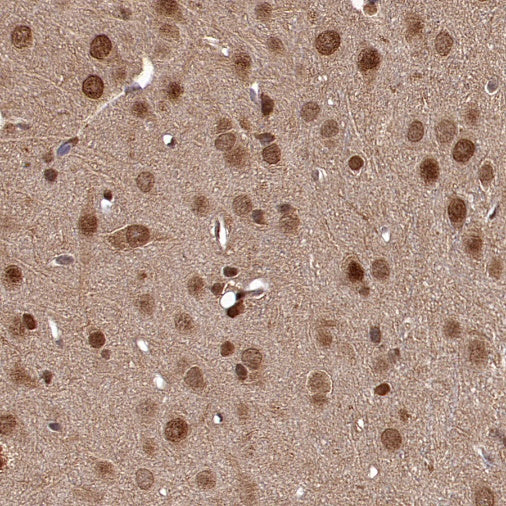 VCP Recombinant Rabbit mAb (S-1818-121)