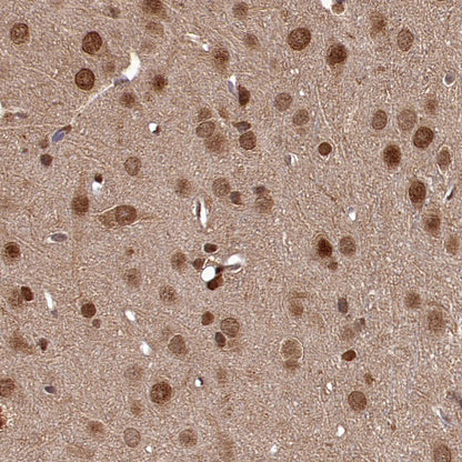 VCP Recombinant Rabbit mAb (S-1818-121)