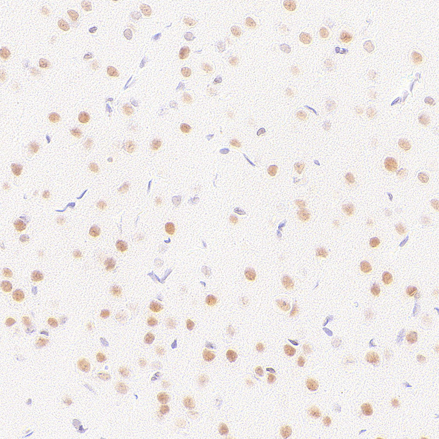 BAP1 Recombinant Rabbit mAb (S-6199)