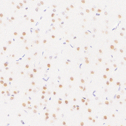 BAP1 Recombinant Rabbit mAb (S-6199)