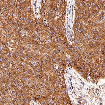 PABP Recombinant Rabbit mAb (S-1744-42)