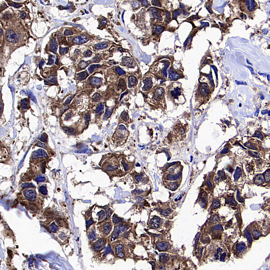 WWP1 Recombinant Rabbit mAb (S-4412-25)