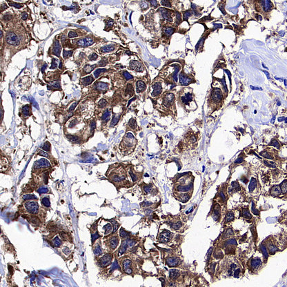 WWP1 Recombinant Rabbit mAb (S-4412-25)