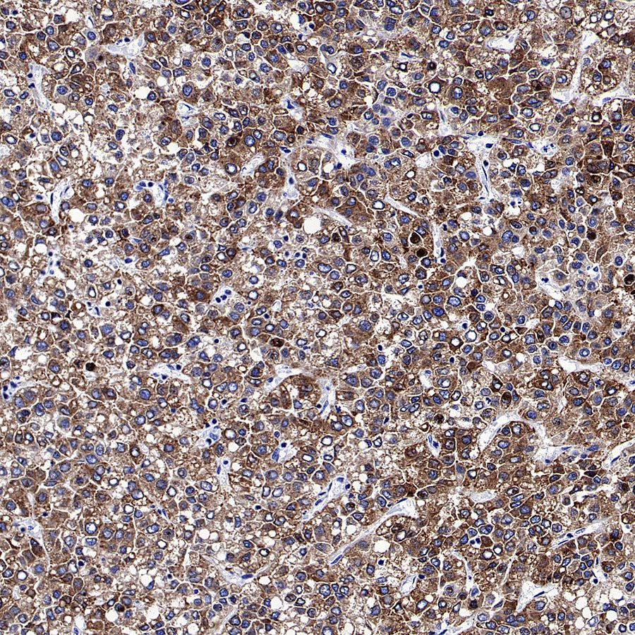 Glypican-3 Recombinant Rabbit mAb (SDT-4064-69)