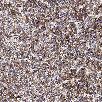 Glypican-3 Recombinant Rabbit mAb (SDT-4064-69)