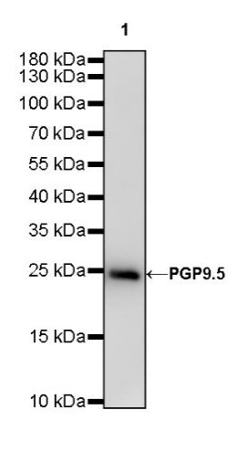 PGP9.5 Recombinant Rabbit mAb (S-R281)