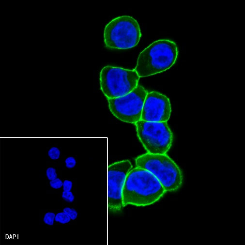 p120 Catenin Recombinant Rabbit mAb (SDT-350-75)