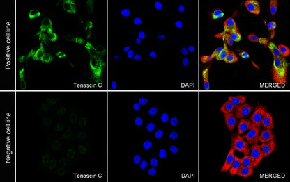 Tenascin C Recombinant Rabbit mAb (S-775-274)