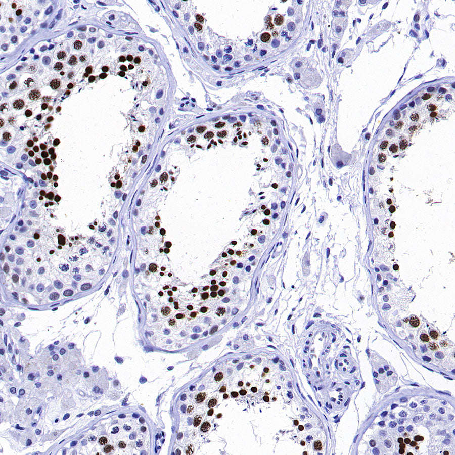 CREM Recombinant Rabbit mAb (S-3375-19)