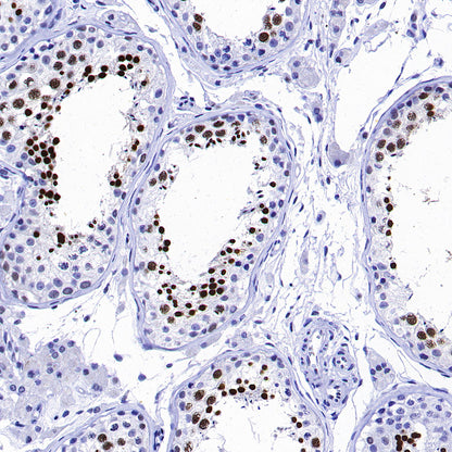 CREM Recombinant Rabbit mAb (S-3375-19)
