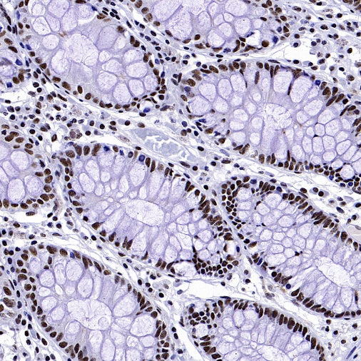 WTAP Recombinant Rabbit mAb (S-2741-49)