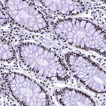 WTAP Recombinant Rabbit mAb (S-2741-49)