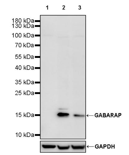GABARAP Recombinant Rabbit mAb (S-2372-47)