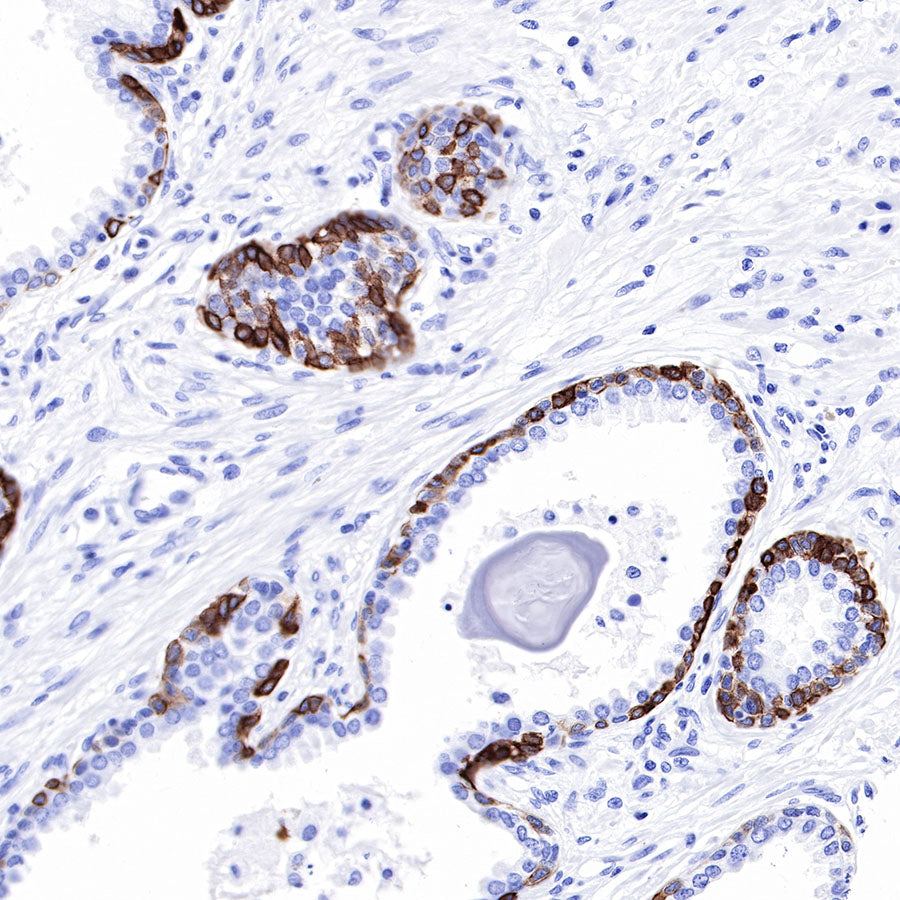Keratin 17 Recombinant Rabbit mAb (SDT-011-43)