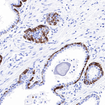 Keratin 17 Recombinant Rabbit mAb (SDT-011-43)