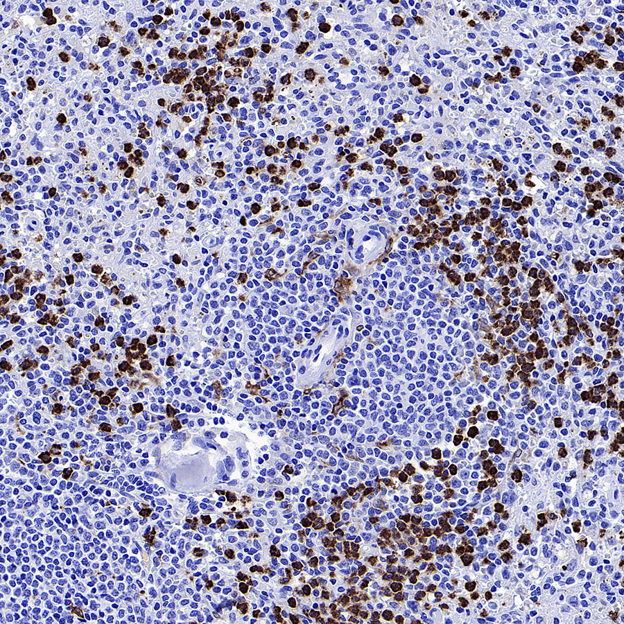 MMP9 Recombinant Rabbit mAb (S-3915-36)