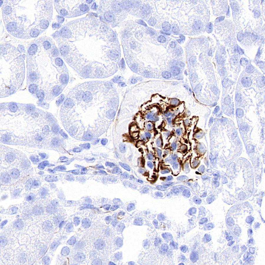 Nestin Recombinant Rabbit mAb (S-3890-112)