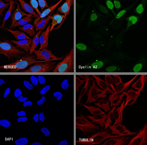 Cyclin A2 Recombinant Rabbit mAb (S-1873-103)