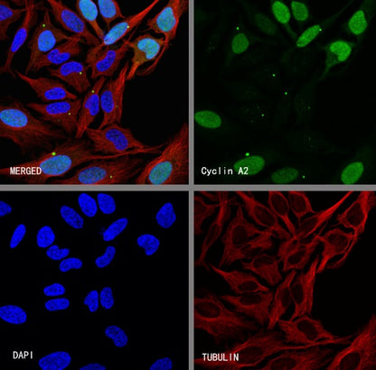 Cyclin A2 Recombinant Rabbit mAb (S-1873-103)