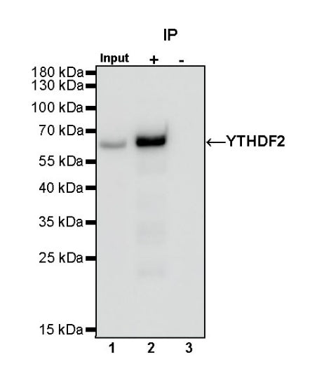 YTHDF2 Recombinant Rabbit mAb (S-1569-42)