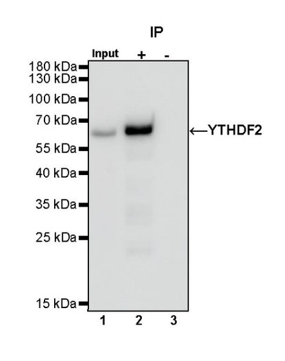 YTHDF2 Recombinant Rabbit mAb (S-1569-42)