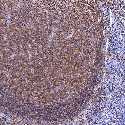 CD19 Recombinant Rabbit mAb (SDT-164-33)