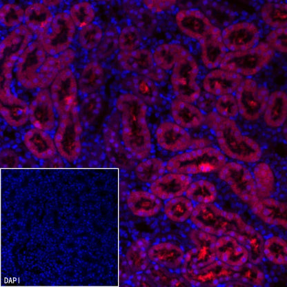AMACR/p504s Recombinant Rabbit mAb (Alexa Fluor® 555 Conjugate) (SDT-401-29)