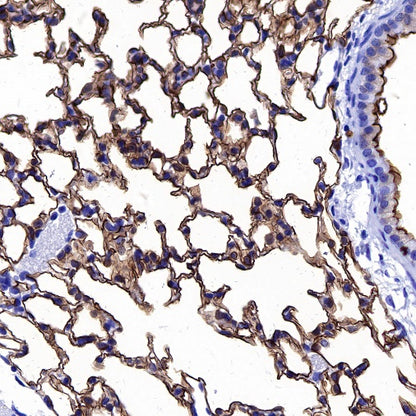 Aquaporin 5/AQP5 Recombinant Rabbit mAb (S-1610-43)