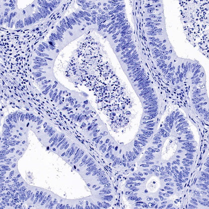 Myelin Oligodendrocyte Glycoprotein (MOG) Recombinant Rabbit mAb (S-1384-61)