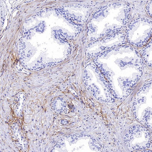 Collagen III Recombinant Mouse mAb (S-3838)