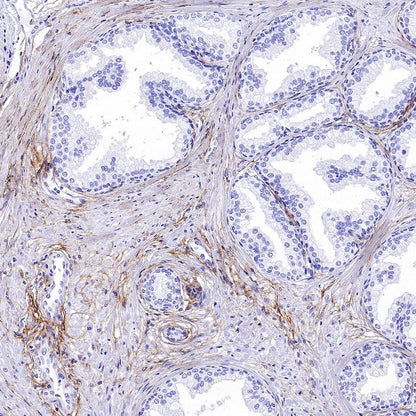 Collagen III Recombinant Mouse mAb (S-3838)