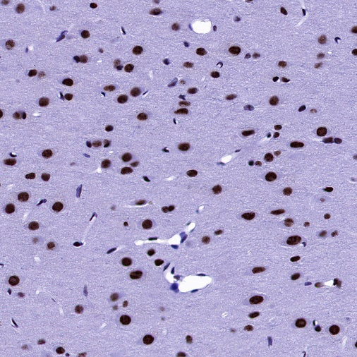U2AF2 Recombinant Rabbit mAb (S-1324-66)