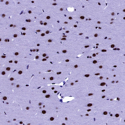U2AF2 Recombinant Rabbit mAb (S-1324-66)