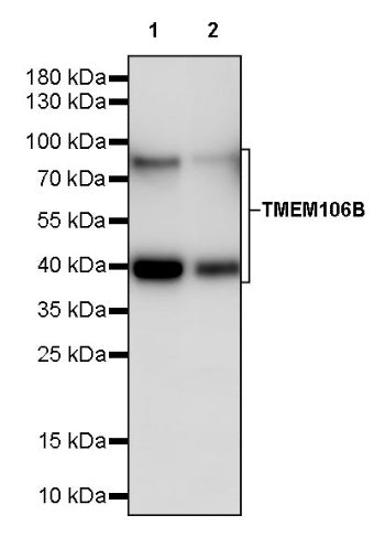 TMEM106B Recombinant Rabbit mAb (S-2362-33)