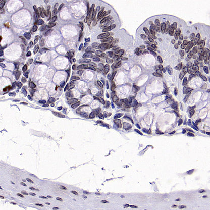 Lamin B1 Recombinant Rabbit mAb (S-5361)