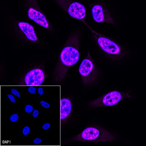 PCNA Recombinant Rabbit mAb (Alexa Fluor® 647 Conjugate) (SDT-297-116)