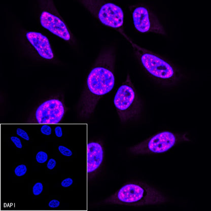 PCNA Recombinant Rabbit mAb (Alexa Fluor® 647 Conjugate) (SDT-297-116)
