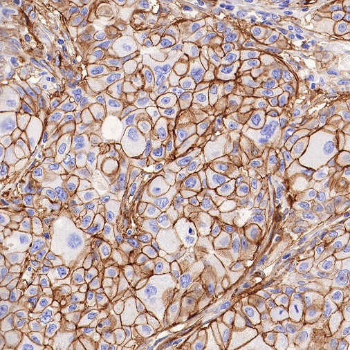 B7-H3 Recombinant Rabbit mAb (SDT-249-26)