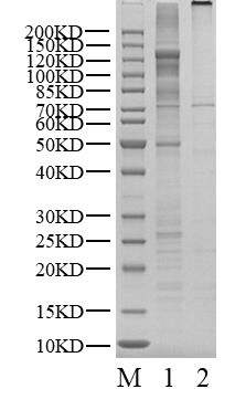 ARG(ABL2)