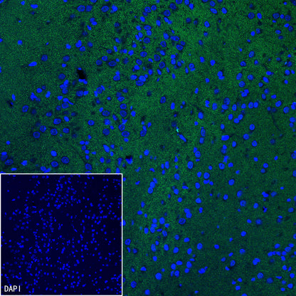Homer1 Recombinant Rabbit mAb (S-3405-360)