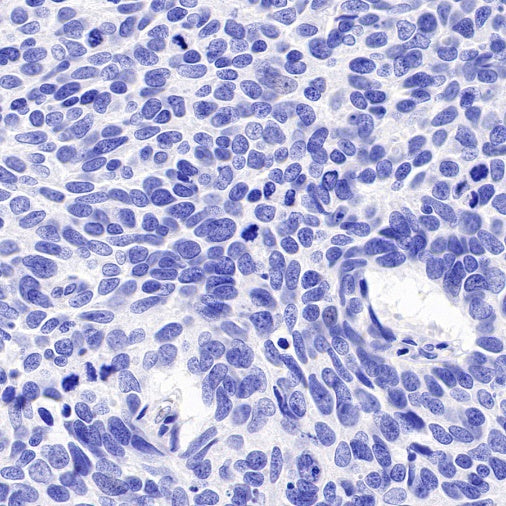 PAX8 Recombinant Rabbit mAb (SDT-R509)