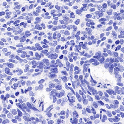PAX8 Recombinant Rabbit mAb (SDT-R509)