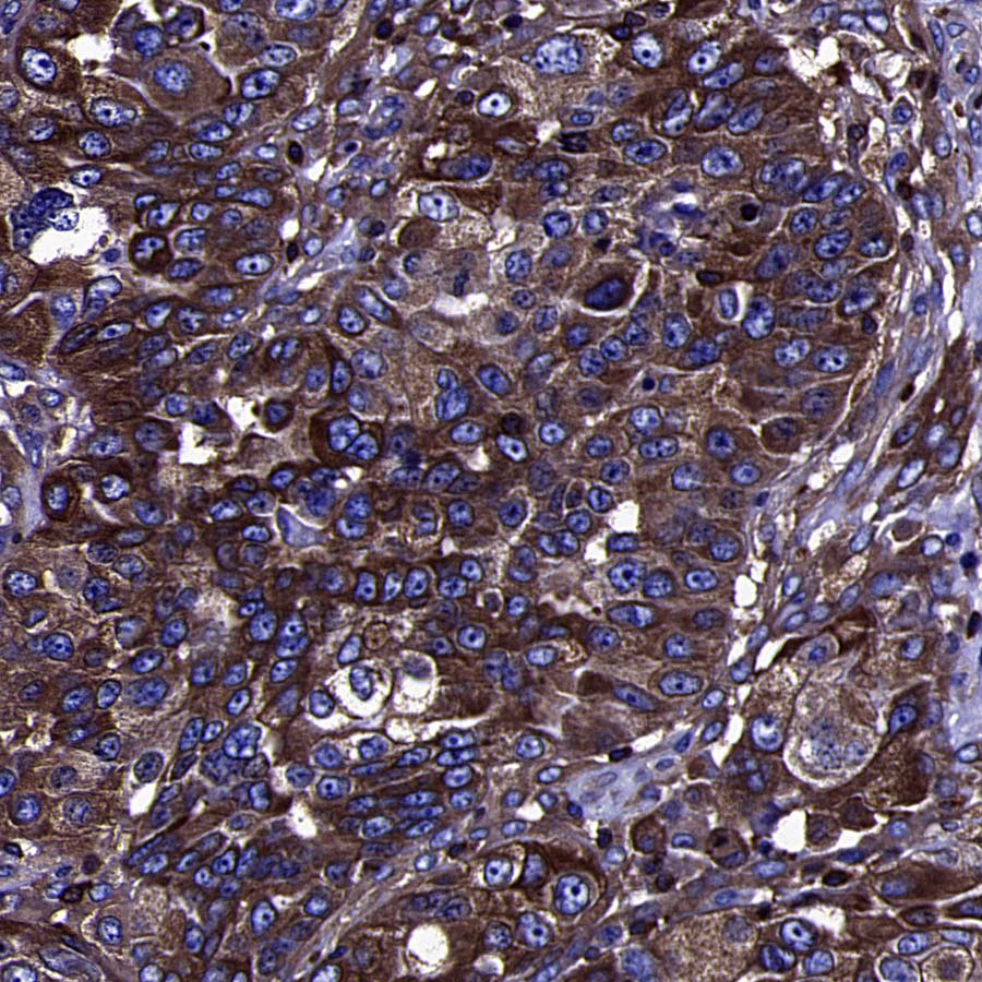 BIN1 Recombinant Rabbit mAb (S-4287-18)