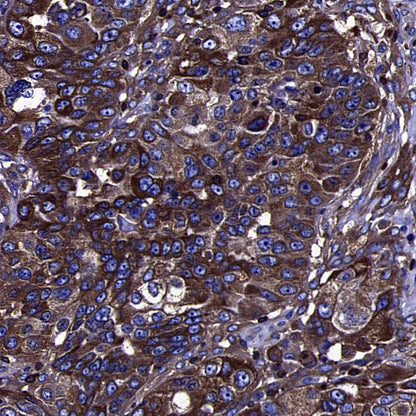 BIN1 Recombinant Rabbit mAb (S-4287-18)